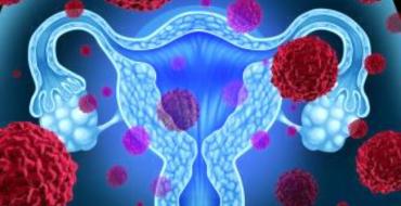 Симптомы и признаки рака шейки матки на ранней стадии Рак шейки матки как называется